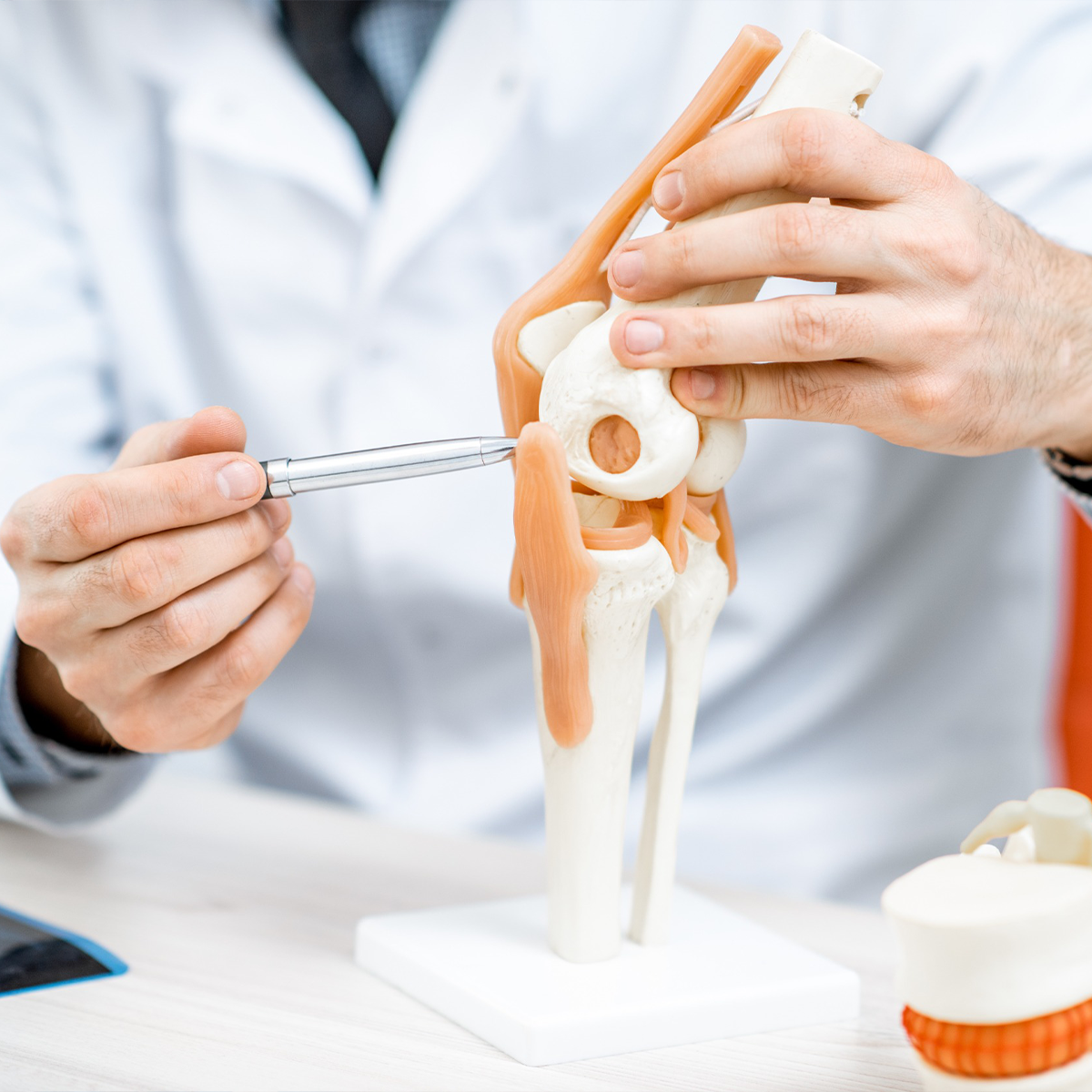 Photo of a doctor looking at a model of a joint